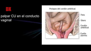 DX
palpar CU en el conducto
vaginal
 