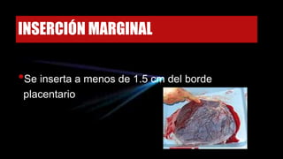 INSERCIÓN MARGINAL
•Se inserta a menos de 1.5 cm del borde
placentario
 