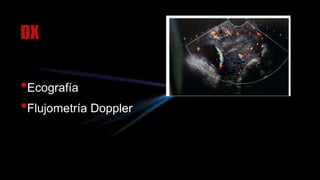 DX
•Ecografía
•Flujometría Doppler
 