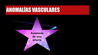 ANOMALÍAS VASCULARES
Ausencia
de una
arteria
 