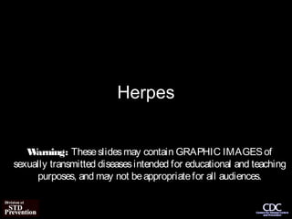 Herpes


   W arning: These slides may contain GRAPHIC IMAGES of
sexually transmitted diseases intended for educational and teaching
     purposes, and may not be appropriate for all audiences.
 