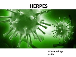 HERPES
Presented by-
Rohit.
 