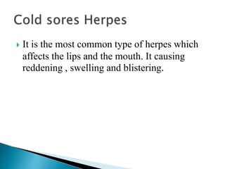  It is the most common type of herpes which
affects the lips and the mouth. It causing
reddening , swelling and blistering.
 