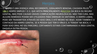 • O HERPES É UMA DOENÇA VIRAL RECORRENTE, GERALMENTE BENIGNA, CAUSADA PELOS
VÍRUS HERPES SIMPLEX 1 E 2, QUE AFETA PRINCIPALMENTE AMUCOSA DA BOCA OU REGIÃO
GENITAL, MAS PODE CAUSAR GRAVES COMPLICAÇÕES NEUROLÓGICAS. NÃO TEM CURA, MAS
ALGUNS REMÉDIOS PODEM SER UTILIZADOS PARA DIMINUIR OS SINTOMAS. A HERPES LABIAL
PODE SER TRANSMITIDA ATRAVÉS DO SEXO ORAL E ATÉ MESMO NO BEIJO. ASSIM TAMBÉM É O
CONTAGIO DA HERPES GENITAL. SE A PESSOA QUE TEM O VÍRUS E, A "FERIDA" NA BOCA, E
FIZER SEXO ORAL NO SEU PARCEIRO, CERTAMENTE ESTARÁ CONTAMINANDO A ÁREA GENITAL
DAQUELA OUTRA PESSOA.
 