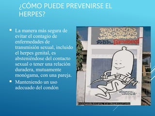 ¿CÓMO PUEDE PREVENIRSE EL
HERPES?
■
■
La manera más segura de
evitar el contagio de
enfermedades de
transmisión sexual, incluido
el herpes genital, es
absteniéndose del contacto
sexual o tener una relación
duradera, mutuamente
monógama, con una pareja.
Manteniendo un uso
adecuado del condón
 