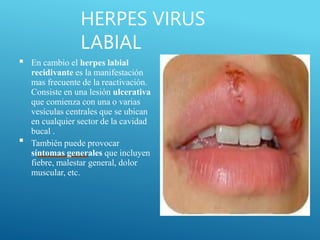 HERPES VIRUS
LABIAL
■
■
En cambio el herpes labial
recidivante es la manifestación
mas frecuente de la reactivación.
Consiste en una lesión ulcerativa
que comienza con una o varias
vesículas centrales que se ubican
en cualquier sector de la cavidad
bucal .
También puede provocar
síntomas generales que incluyen
fiebre, malestar general, dolor
muscular, etc.
 