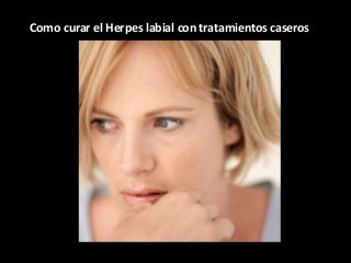 Como curar el Herpes labial con tratamientos caseros
 