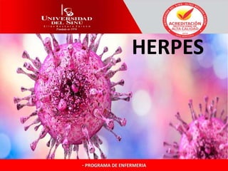 HERPES
 