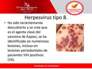 Herpesvirus tipo 8.
• Ha sido recientemente
descubierto y se cree que
es el agente clave del
sarcoma de Kaposi, se ha
identificado en numerosas
lesiones, incluso en
lesiones periodontales de
pacientes VIH positivos
(33).
 