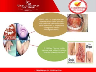 EL HSV tipo 1 es un virus de gran
tamaño y neurotrópico que causa
principalmente infecciones orales,
desde leves como el herpes labial
hasta graves como la
meningoencefalitis.
El HSV tipo 2 es muy similar
pero da lugar a infecciones ano-
genitales o herpes neonatal.
 