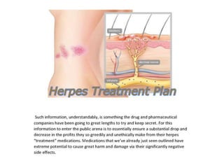 Herpes 1 & 2