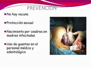 PREVENCIÓN
⚫No hay vacuna
⚫Protección sexual
⚫Nacimiento por cesárea en
madres infectadas
⚫Uso de guantes en el
personal médico y
odontológico
 