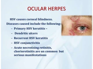 HERPES VIRUS | PPTX