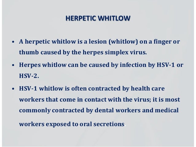 Herpes Virus