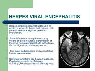 HERPES VIRAL ENCEPHALITIS 
 Herpes simplex encephalitis (HSE) is an 
acute or subacute illness that causes both 
general and focal signs of cerebral 
dysfunction. 
 Brain infection is thought to occur by 
means of direct neuronal transmission of 
the virus from a peripheral site to the brain 
via the trigeminal or olfactory nerve. 
 The exact pathogenesis and precipitating 
factors are unknown. 
 Common symptoms are Fever, Headache, 
Psychiatric symptoms, Seizures, 
Vomiting ,Focal weakness & Memory loss. 
 