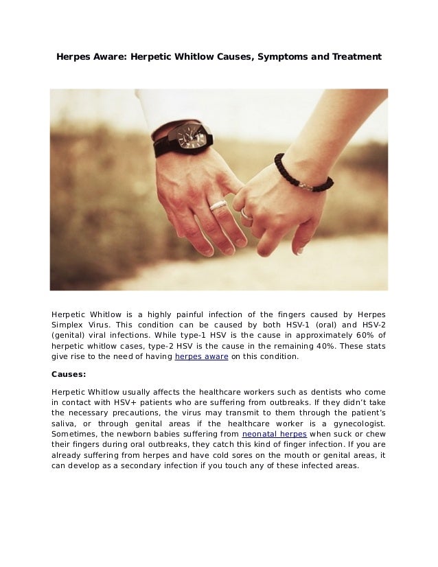 Herpes aware herpetic whitlow causes, symptoms and treatment