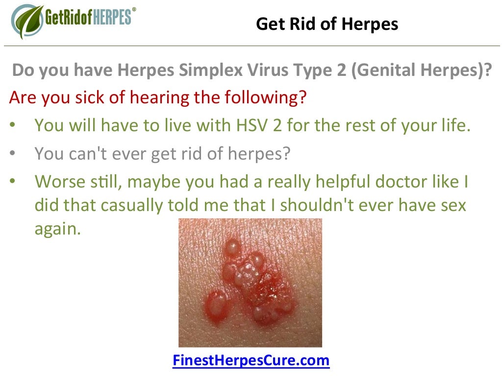 Herpes definition