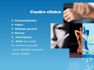 Cuadro clinico
 Fotosensibilidad
 Fiebre

 Malestar general
 Picores
 Hormigueos
 Dolor que puede

ser extremo (zona del
nervio afectado) punzante,
urente, picante.

 