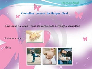 Conselhos  Acerca  do Herpes  Oral Não toque na ferida -  risco de transmissão e infecção secundária Lave as mãos Evite 