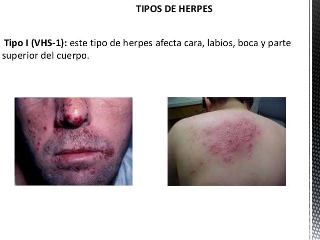Quiero aumentará el miembro