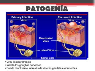 PATOGENÍAInfección primaria mucocutaneaInfección ganglionar agudaEstablecimiento de latencia, reactivación, reinfección frecuente.VHS es neurotrópico