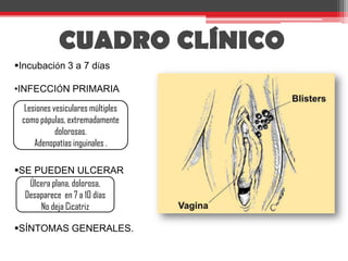 Infecta los ganglios nerviosos