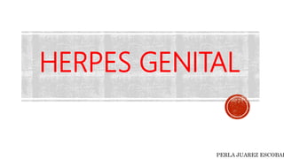 HERPES GENITAL
PERLA JUAREZ ESCOBAR
 