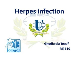 Herpes infection

Ghodiwala Tossif
Ml-610

 