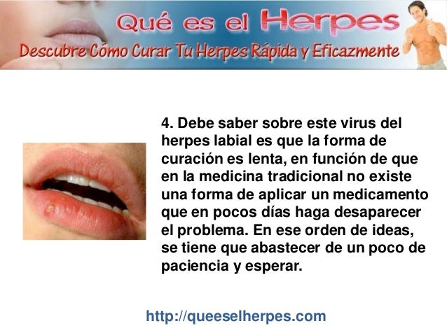 5 Cosas que debes saber sobre El Herpes Labial Aparador Com Espelho ~ 5 Cosas que debes saber sobre El Herpes Labial
