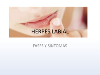 HERPES LABIAL
FASES Y SINTOMAS
 