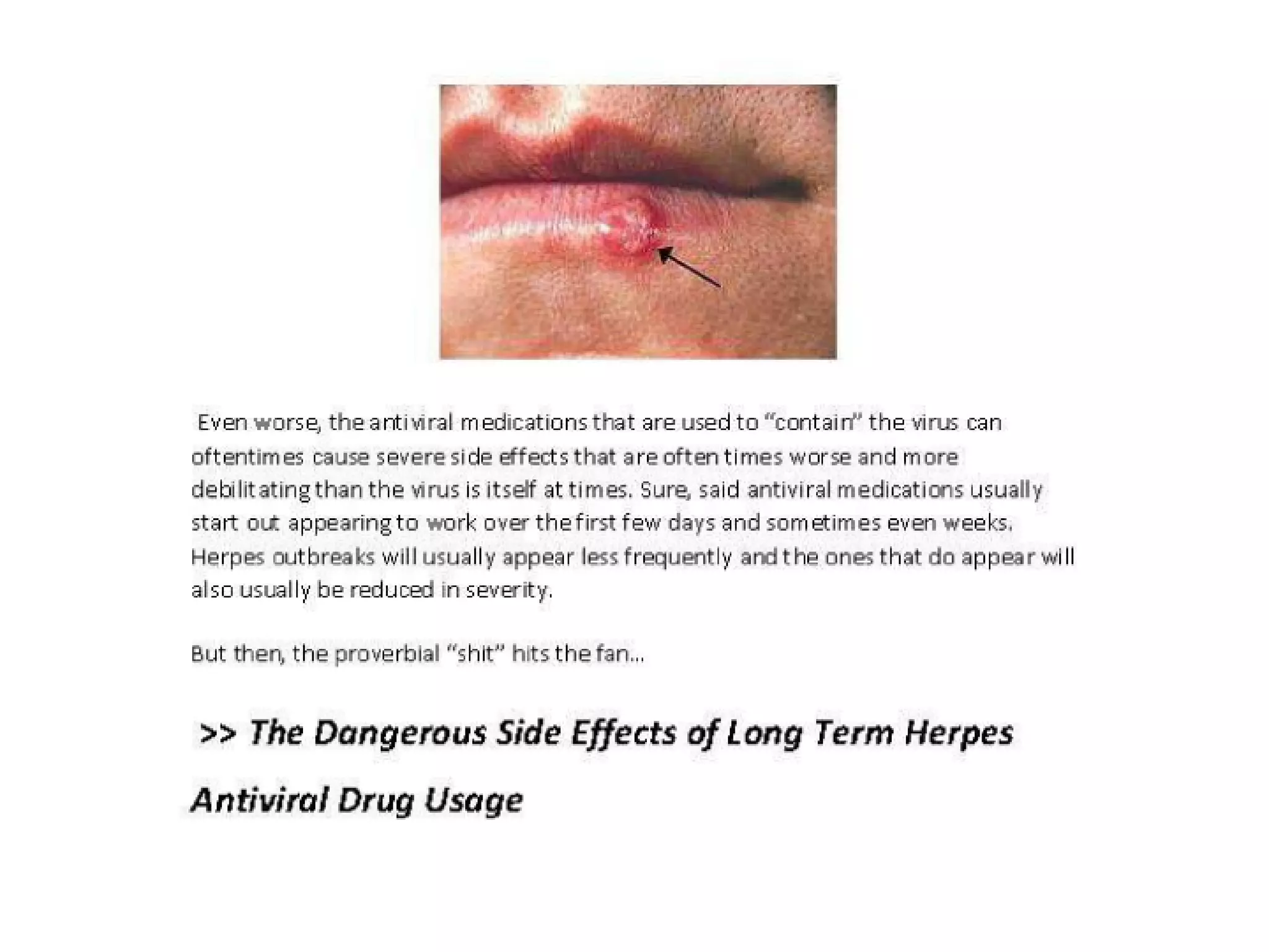 Waxing Horror Story: Herpes Outbreak Revealed - eg5xlyo
