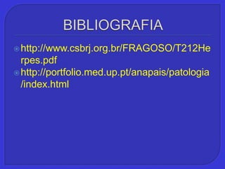 BIBLIOGRAFIAhttp://www.csbrj.org.br/FRAGOSO/T212Herpes.pdfhttp://portfolio.med.up.pt/anapais/patologia/index.html