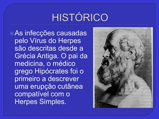 HISTÓRICO,[object Object],As infecções causadas pelo Vírus do Herpes são descritas desde a Grécia Antiga. O pai da medicina, o médico grego Hipócrates foi o primeiro a descrever uma erupção cutânea compatível com o Herpes Simples.,[object Object]
