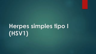 Herpes simples tipo I 
(HSV1) 
 
