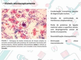 Pública
• Visíveis microscopicamente
- Condensação cromatínica seguida
de degeneração nuclear;
- Solução de continuidade de
membranas citoplasmáticas;
- Perda de proteínas de ligação
matricial sobre a superfície celular,
com despregamento celular de
tecido circunjacente;
- Desestabilização citoesquelética;
- Diminuição de sítese
macromolecular.
 