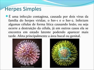 Herpes Simples
É uma infecção contagiosa, causada por dois vírus da

família do herpes viridae, o hsv-1 e o hsv-2. Infectam
algumas células de forma lítica causando lesão, ou seja
ocorre a destruição da célula, já em outros casos ela se
encontra em estado latente podendo aparecer mais
tarde. Afeta principalmente a área bucal ou genital.

 