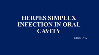 HERPES SIMPLEX
INFECTION IN ORAL
CAVITY
HRISHITA
 