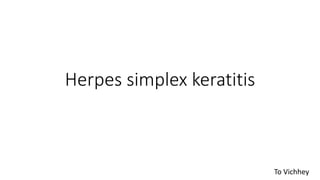 Herpes simplex keratitis
To Vichhey
 