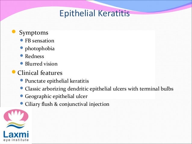 Herpes simplex keratitis & herpes zoster opthalmicus