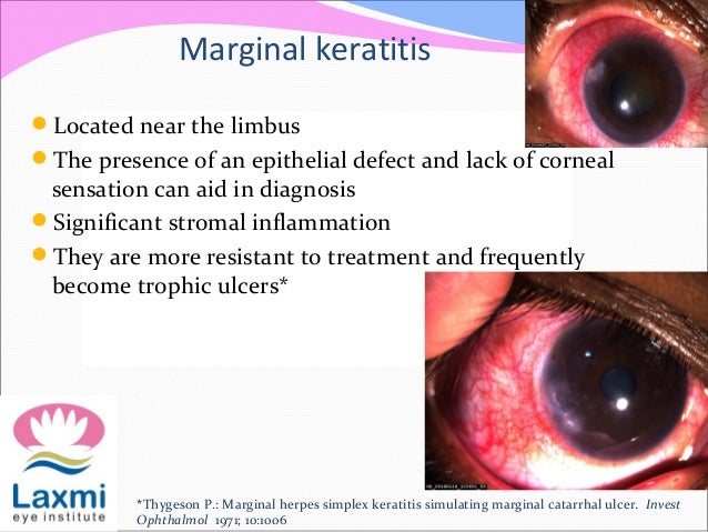 Herpetic ulceration of vulva - RightDiagnosis.com