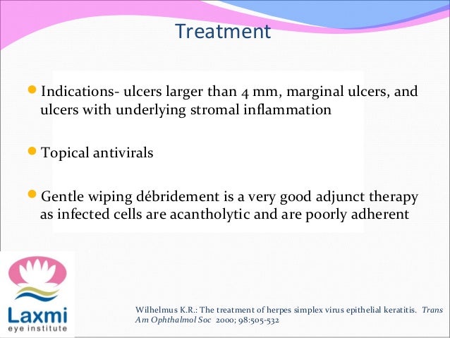 Herpes Simplex Keratitis Herpes Zoster Opthalmicus