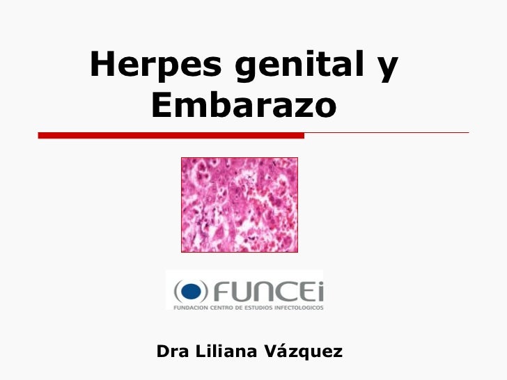 herpes simplex 1 dating Would you be less likely to date someone who carries the hsv-1 virus and has out breaks orally knowing that there are risks of spreading the virus through kissing and oral sex. herpes simplex 1 dating Would you be less likely to date someone who carries the hsv-1 virus and has out breaks orally knowing that there are risks of spreading the virus through kissing and oral sex.
