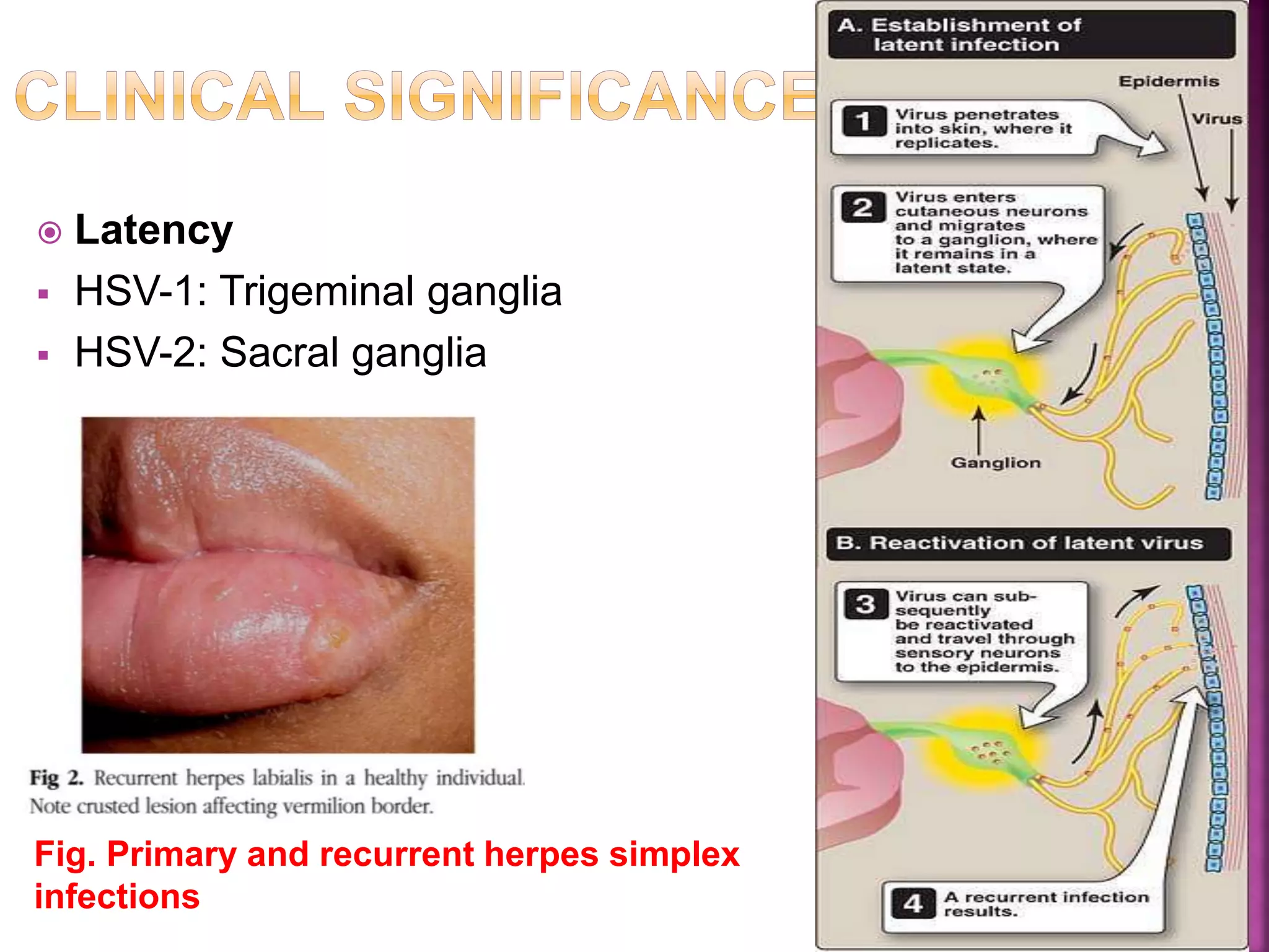  Latency
HSV-1: Trigeminal ganglia
HSV-2: Sacral ganglia
Fig. Primary and recurrent herpes simplex
infections