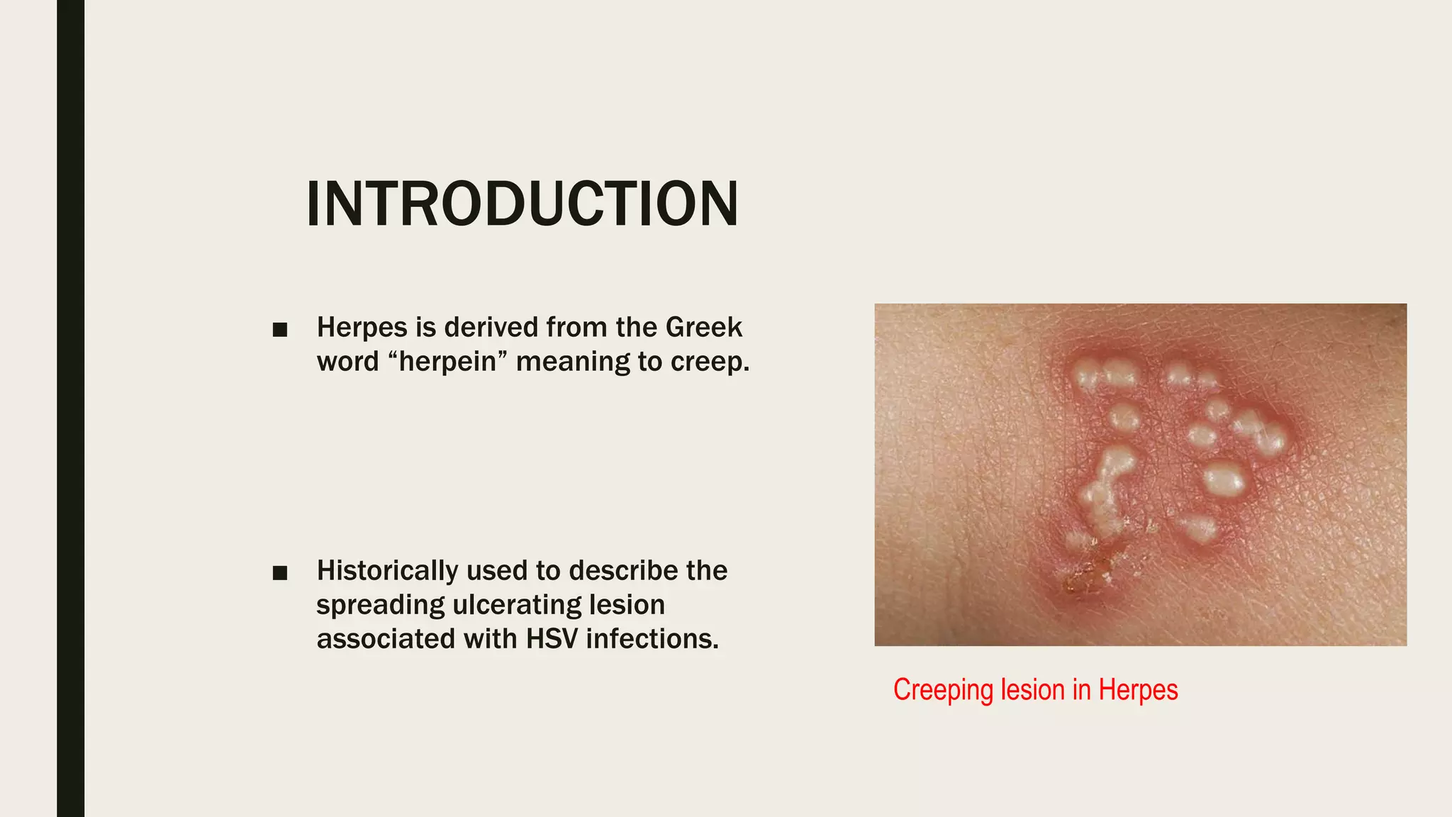 Herpesviridae with lab dx | PPT