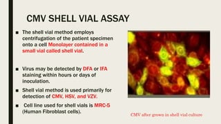 Shell Vial Method Herpesviridae with lab dx | PPTX
