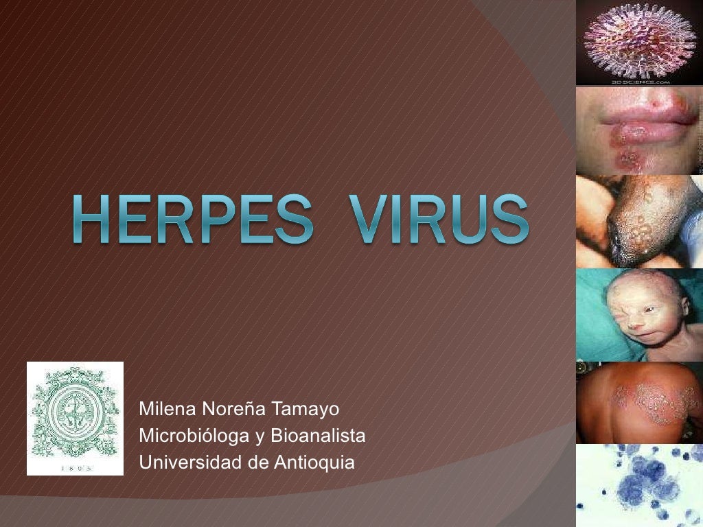 Herpes virus
