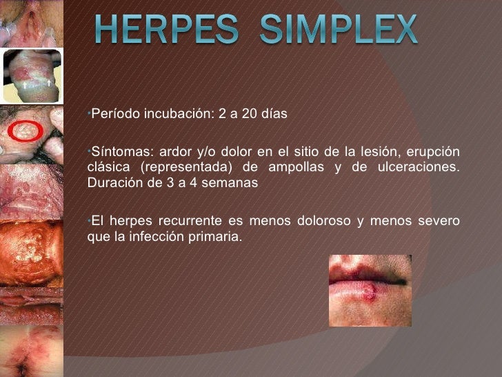 Herpes virus