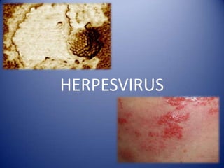 HERPESVIRUS
 