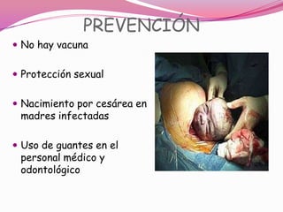 PREVENCIÓN
 No hay vacuna


 Protección sexual


 Nacimiento por cesárea en
 madres infectadas

 Uso de guantes en el
 personal médico y
 odontológico
 
