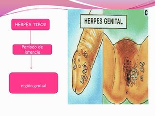 HERPES TIPO2




  Periodo de
   latencia




  región genital
 